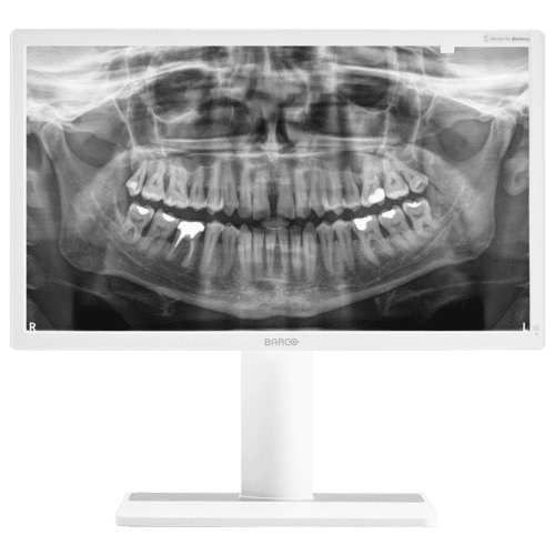 Röntgenaufnahme eines Kiefers mit sichtbaren Zähnen auf einem weißen Monitor.